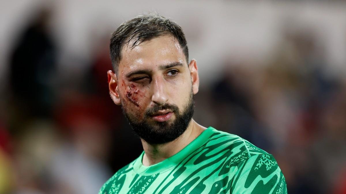 La escalofriante lesión de Donnarumma